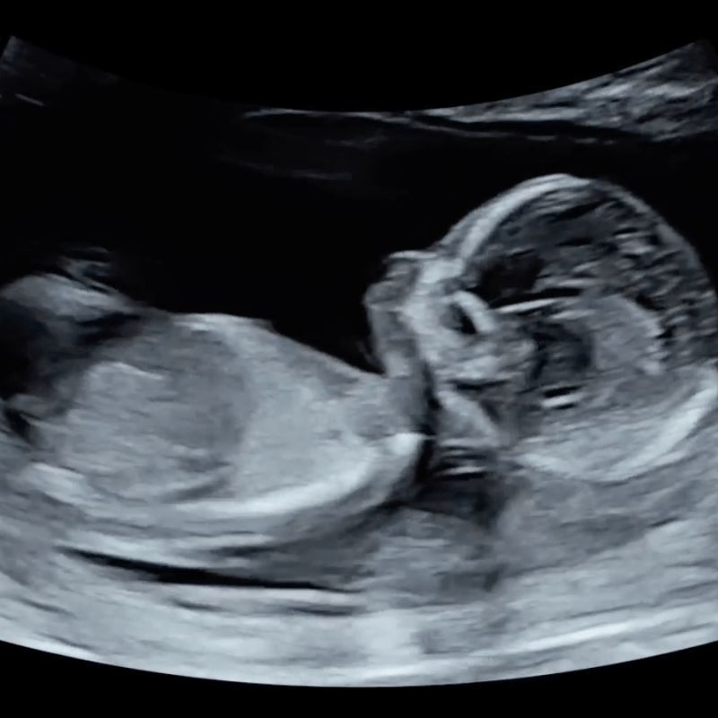 2025: The Year of&nbsp;Growth